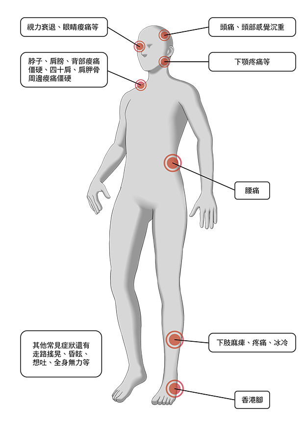 顳顎關節症候群可能會遍及全身的症狀_顳顎關節症候群_Neuromuscular-Disorder_張智洋醫師