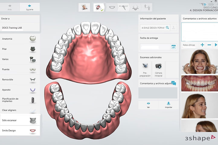 3D列印與CADCAM如何改變了牙科治療4