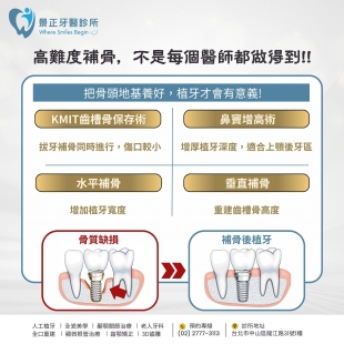 植牙補骨.jpg